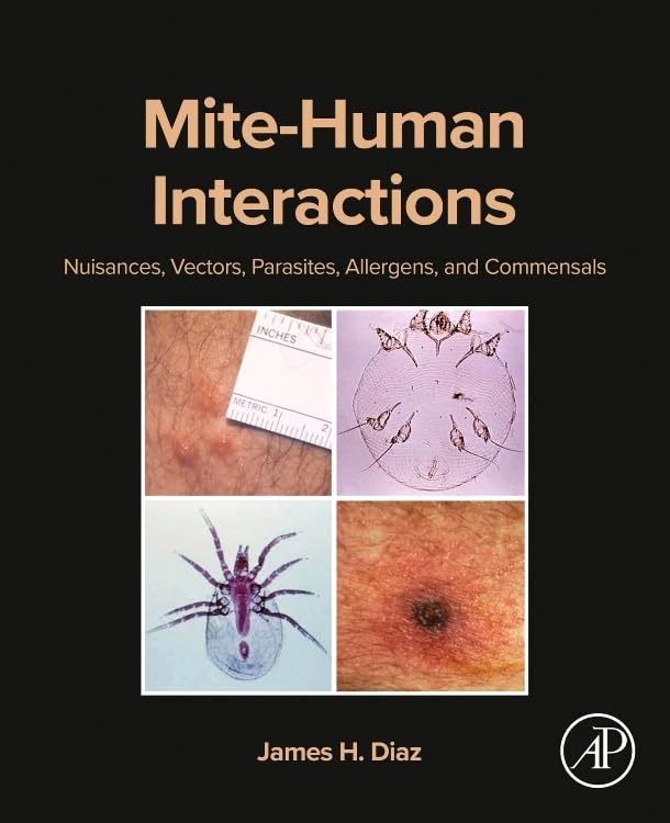 Mite-Human Interactions: Nuisances