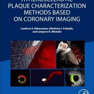 Atherosclerotic Plaque Characterization Methods Based on Coronary Imaging