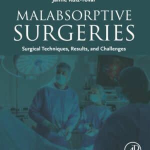 Malabsorptive Surgeries: Surgical Techniques