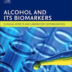 Alcohol and Its Biomarkers: Clinical Aspects and Laboratory Determination