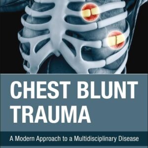 Chest Blunt Trauma: A Modern Approach to a Multidisciplinary Disease