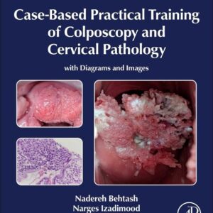 Case-Based Practical Training of Colposcopy and Cervical Pathology: With Diagrams and Images