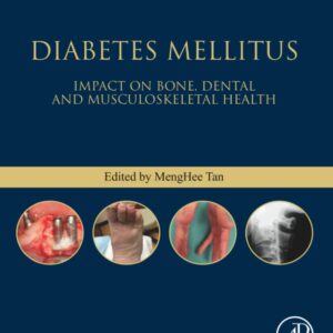 Diabetes Mellitus: Impact on Bone