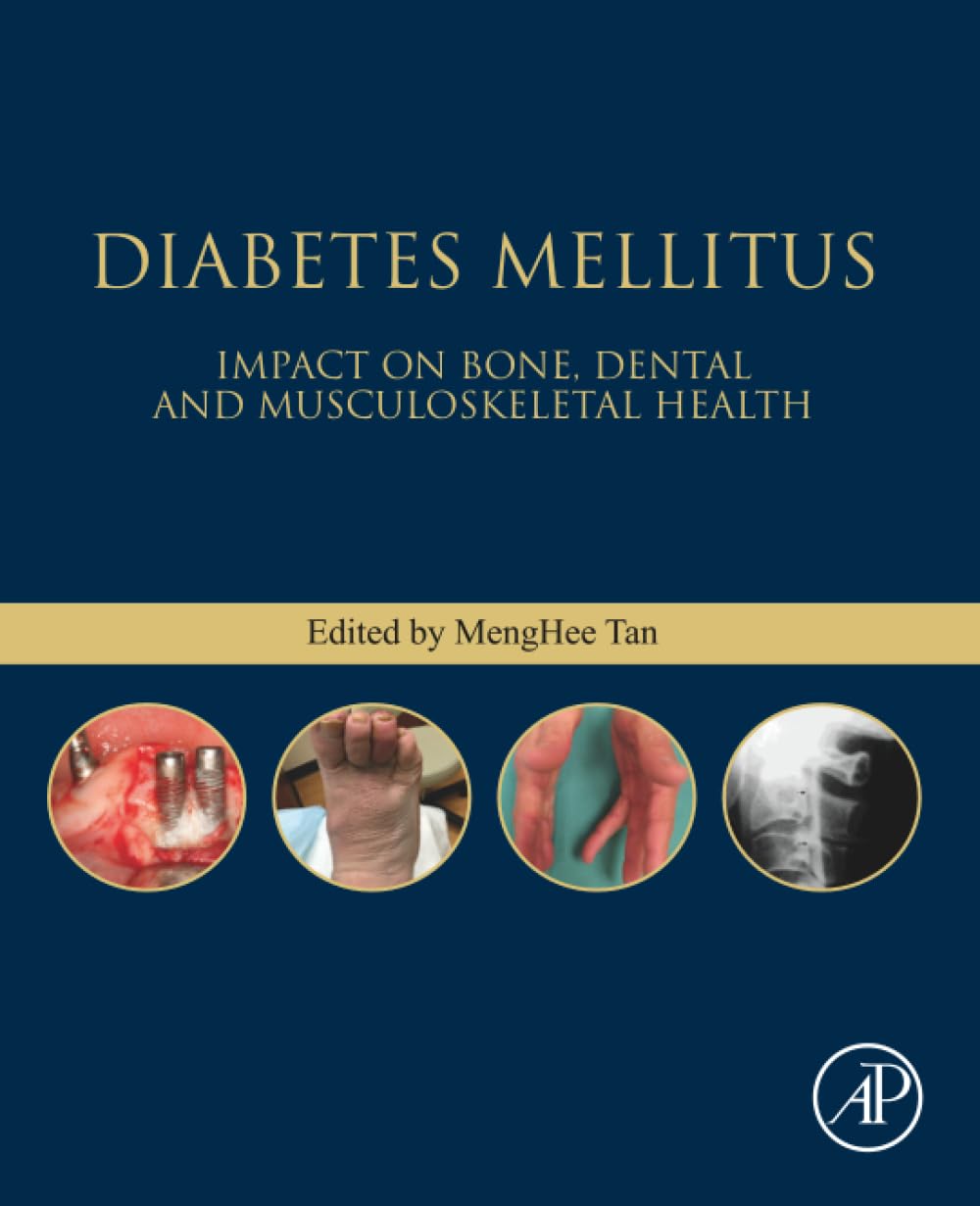 Diabetes Mellitus: Impact on Bone