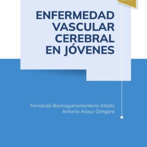 Enfermedad vascular cerebral en jóvenes