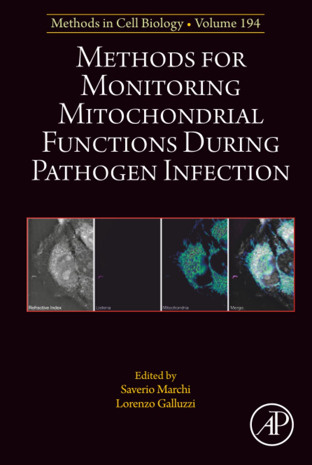 Methods for Monitoring Mitochondrial Functions During Pathogen Infection (Volume 194) (Methods in Cell Biology