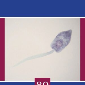 Advances in Parasitology (Volume 89)