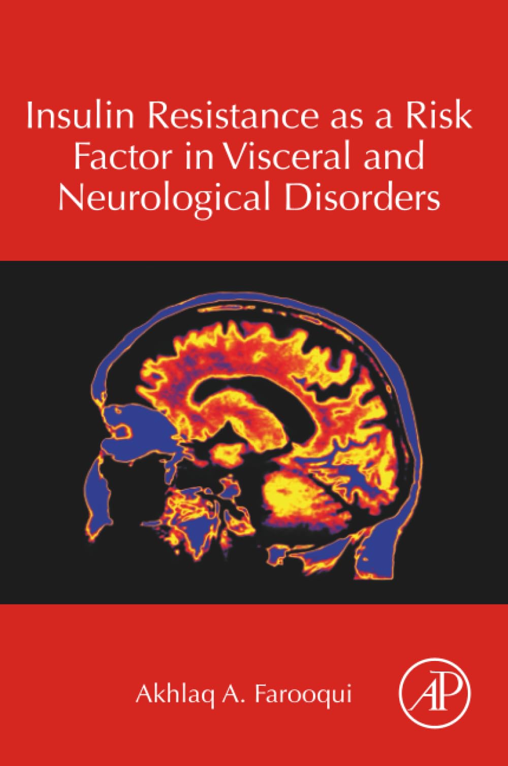 Insulin Resistance as a Risk Factor in Visceral and Neurological Disorders