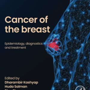 Cancer of the Breast: Epidemiology