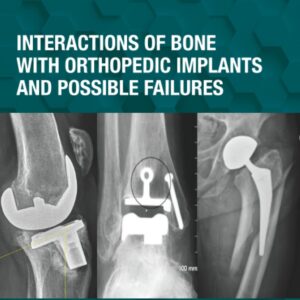 Interactions of Bone with Orthopedic Implants and Possible Failures (Orthopedic Implants and Biomaterials)