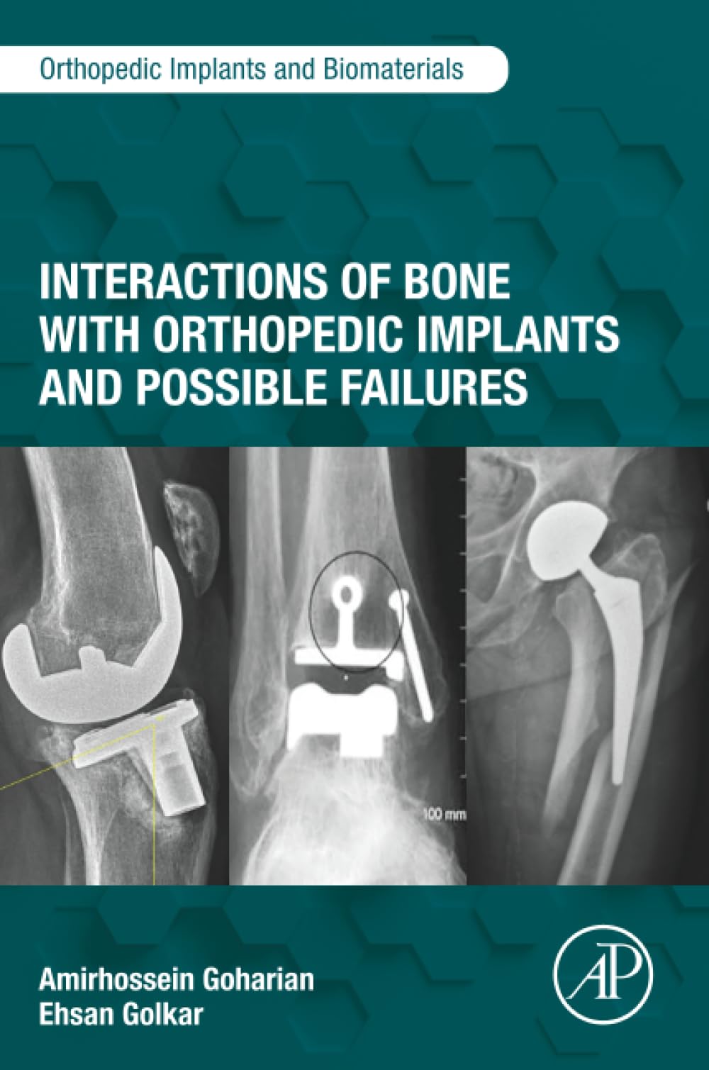 Interactions of Bone with Orthopedic Implants and Possible Failures (Orthopedic Implants and Biomaterials)