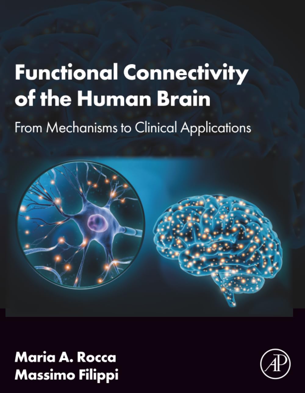 Functional Connectivity of the Human Brain: From Mechanisms to Clinical Applications