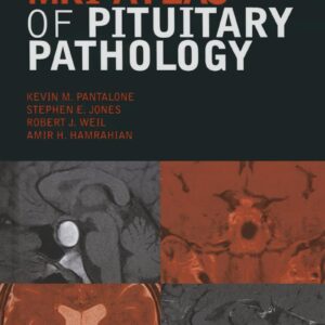 MRI Atlas of Pituitary Pathology