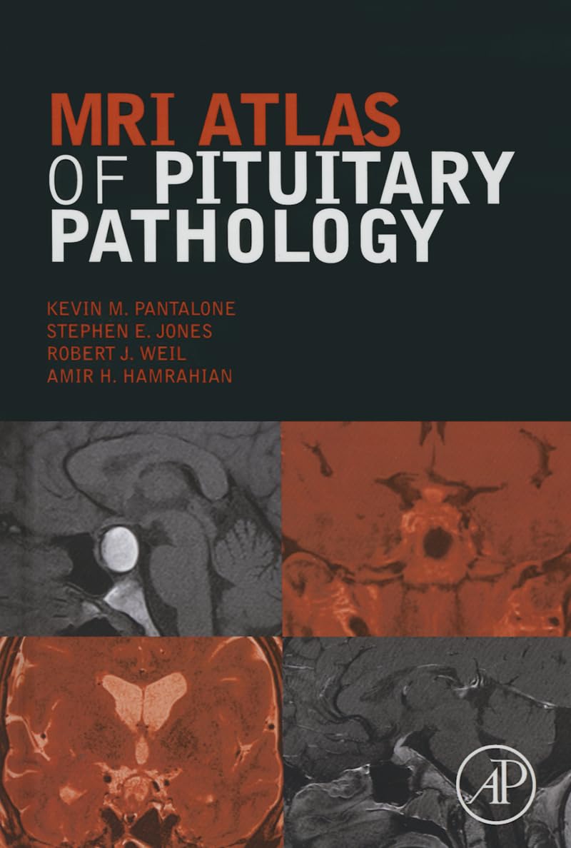 MRI Atlas of Pituitary Pathology