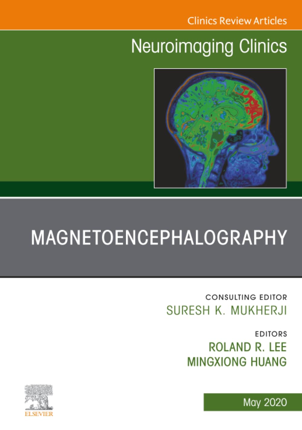 Magnetoencephalography