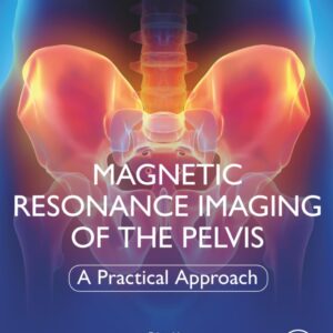 Magnetic Resonance Imaging of The Pelvis: A Practical Approach