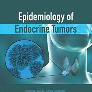 Epidemiology of Endocrine Tumors