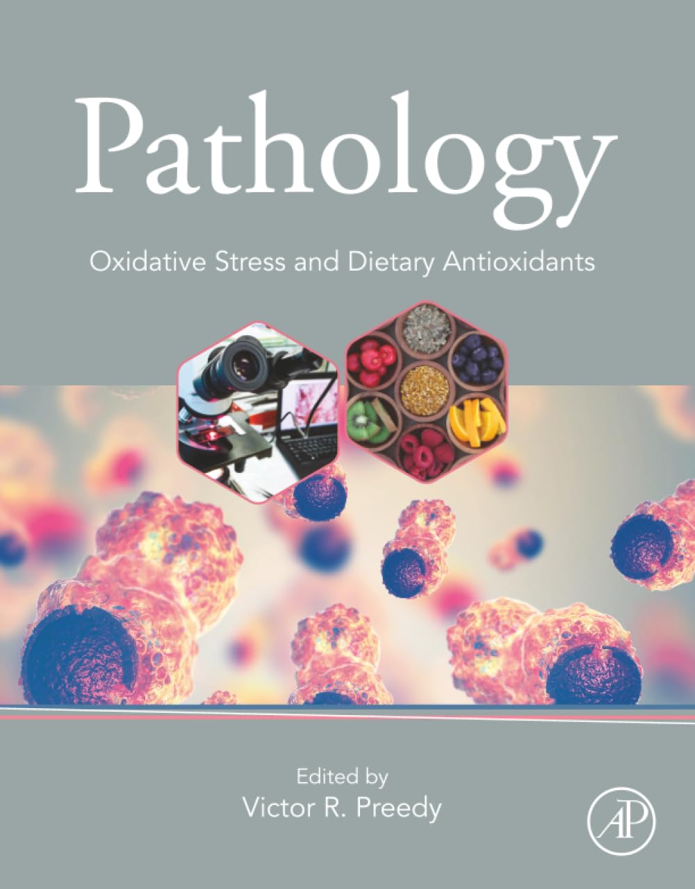Pathology: Oxidative Stress and Dietary Antioxidants