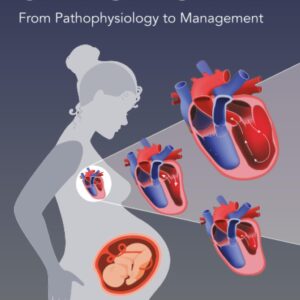 Peripartum Cardiomyopathy: From Pathophysiology to Management