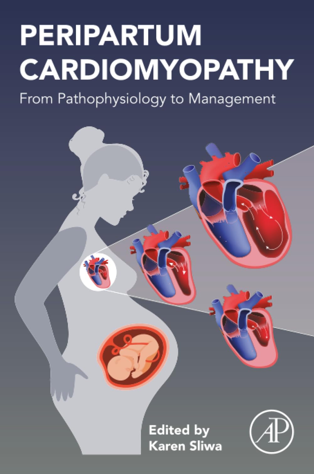 Peripartum Cardiomyopathy: From Pathophysiology to Management