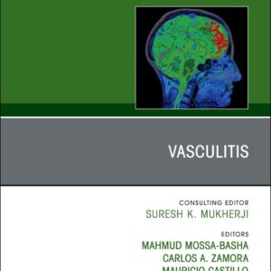 Vasculitis