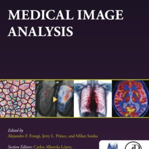 Medical Image Analysis (The MICCAI Society book Series)