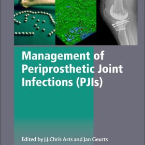 Management of Periprosthetic Joint Infections (PJIs) (Woodhead Publishing Series in Biomaterials)
