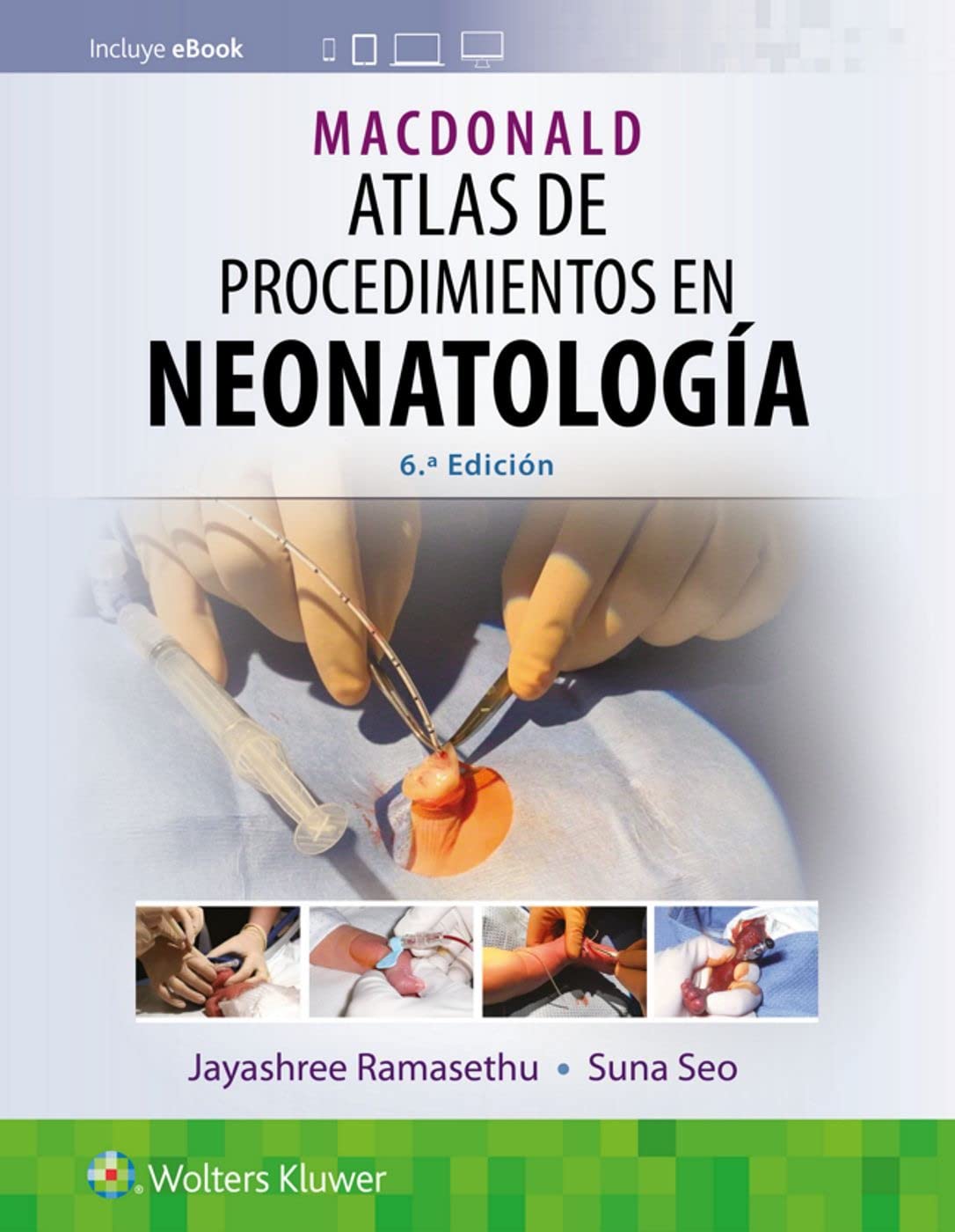 MacDonald. Atlas de procedimientos en neonatologÃa (Spanish Edition)-ISBN: 9788418892462