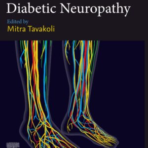 Diabetic Neuropathy