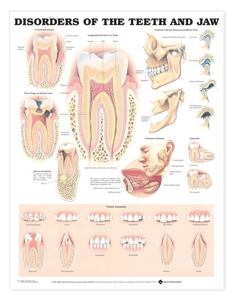 Disorders of the Teeth and Jaw Anatomical Chart-ISBN: 9781587792502