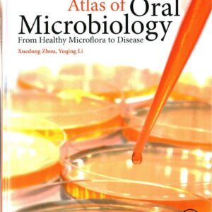 Atlas of Oral Microbiology: From Healthy Microflora to Disease