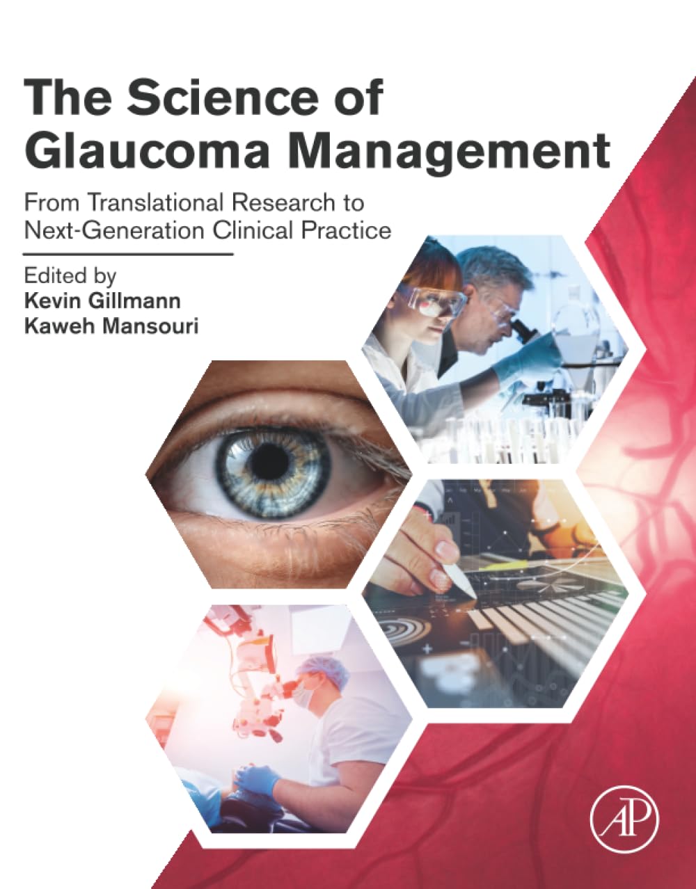 The Science of Glaucoma Management: From Translational Research to Next-Generation Clinical Practice