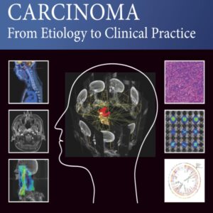 Nasopharyngeal Carcinoma: From Etiology to Clinical Practice