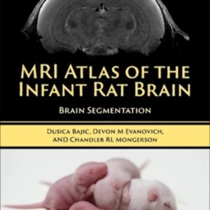 MRI Atlas of the Infant Rat Brain: Brain Segmentation