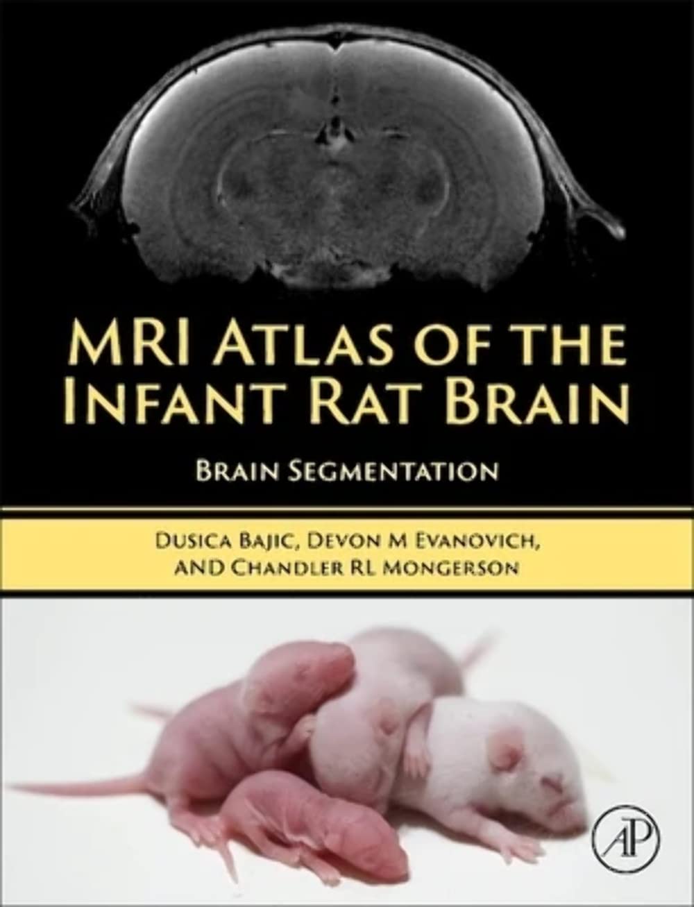 MRI Atlas of the Infant Rat Brain: Brain Segmentation