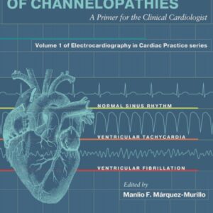 Electrocardiography of Channelopathies: A Primer for the Clinical Cardiologist (Electrocardiography in Cardiac Practice)