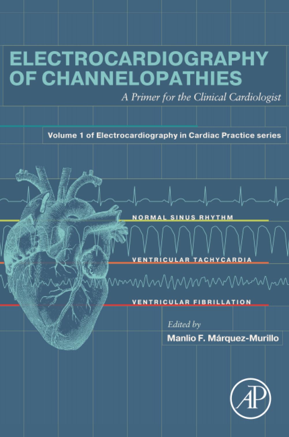 Electrocardiography of Channelopathies: A Primer for the Clinical Cardiologist (Electrocardiography in Cardiac Practice)