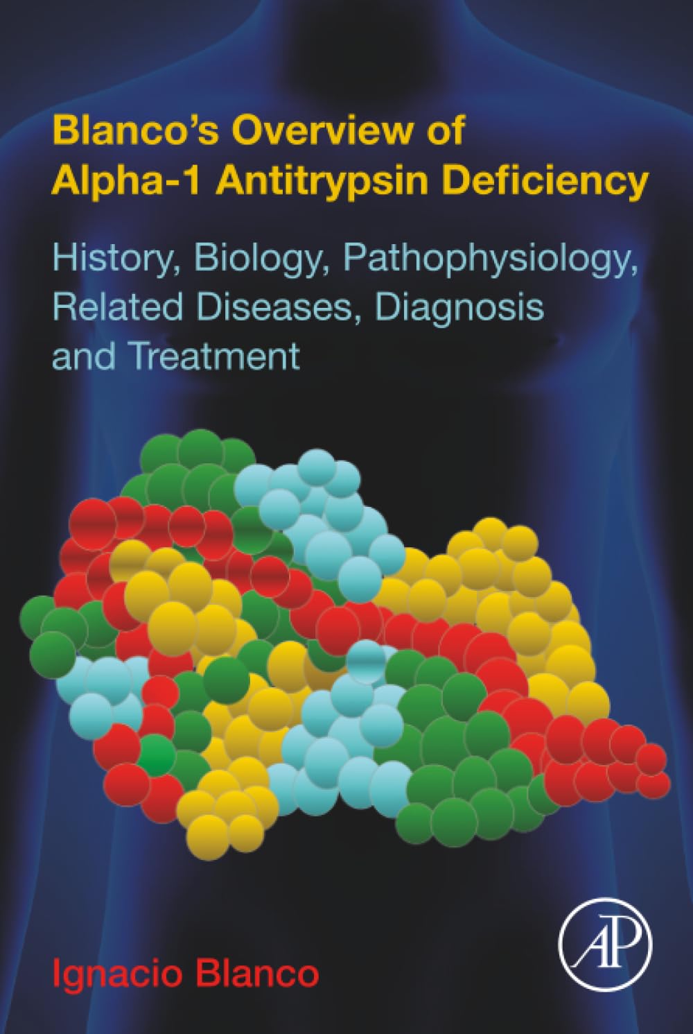 Blanco's Overview of Alpha-1 Antitrypsin Deficiency: History