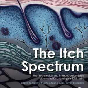 The Itch Spectrum