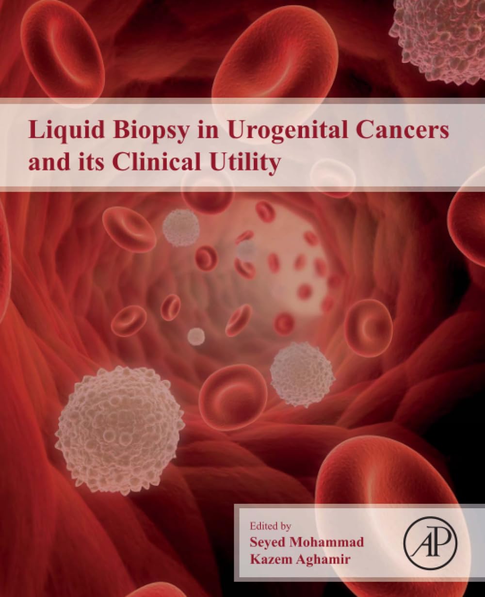 Liquid Biopsy in Urogenital Cancers and its Clinical Utility
