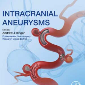 Intracranial Aneurysms