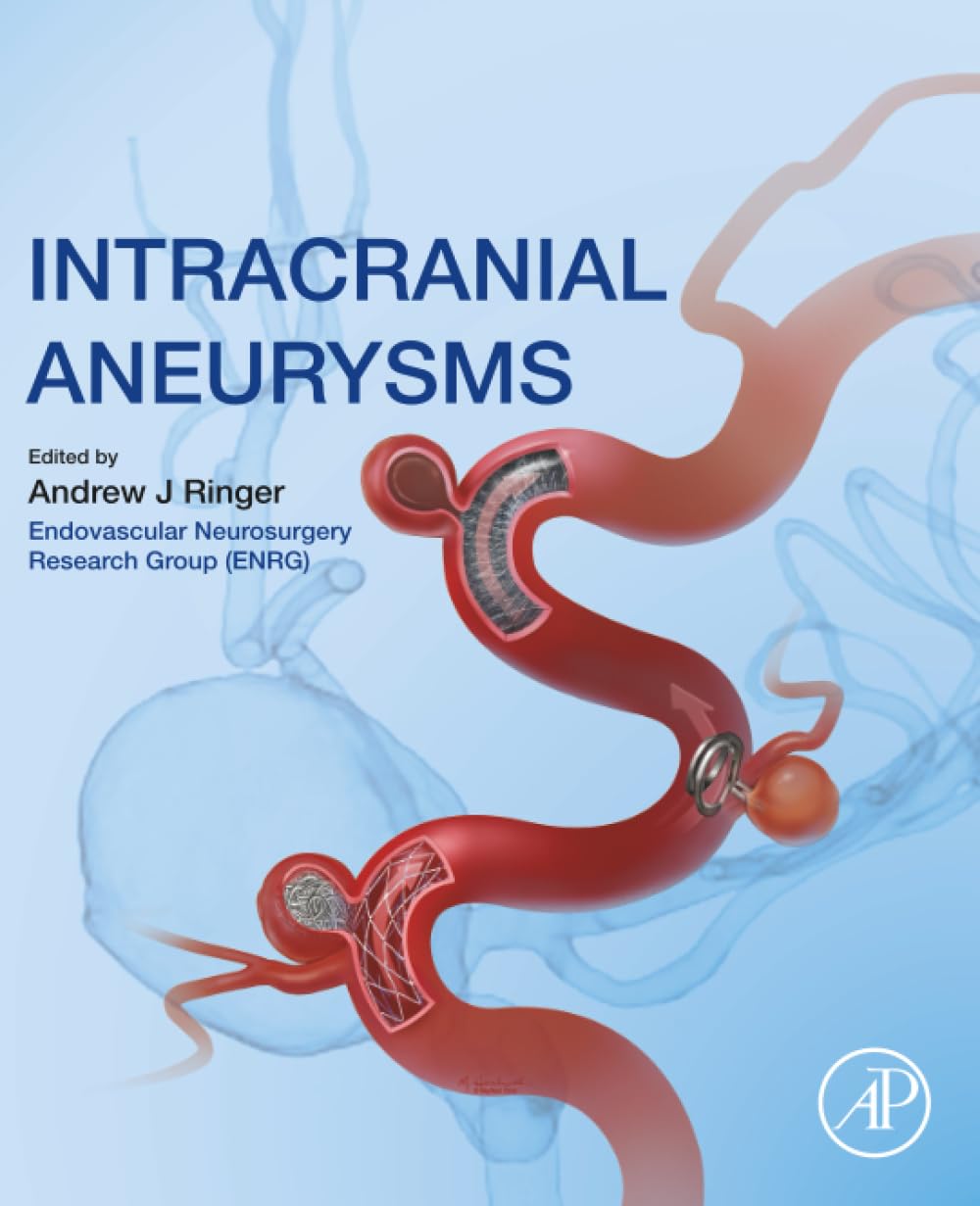 Intracranial Aneurysms