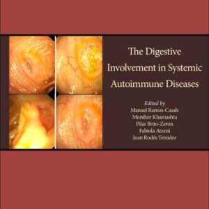 Antiphospholipid Syndrome in Systemic Autoimmune Diseases (Volume 12)
