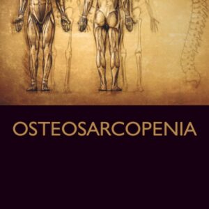 Osteosarcopenia: Understanding Bone