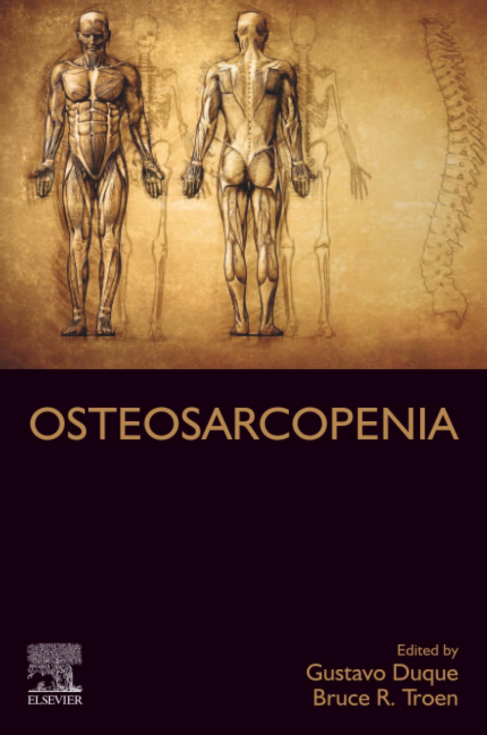 Osteosarcopenia: Understanding Bone