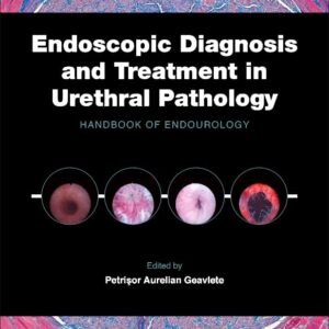 Endoscopic Diagnosis and Treatment in Urethral Pathology: Handbook of Endourology