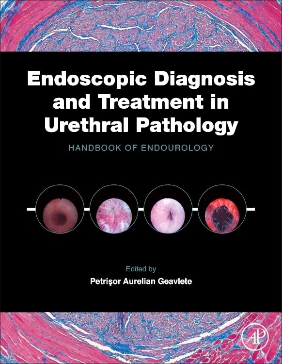 Endoscopic Diagnosis and Treatment in Urethral Pathology: Handbook of Endourology