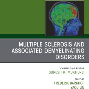 Multiple Sclerosis and Associated Demyelinating Disorders