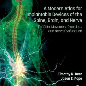 A Modern Atlas for Implantable Devices of the Spine