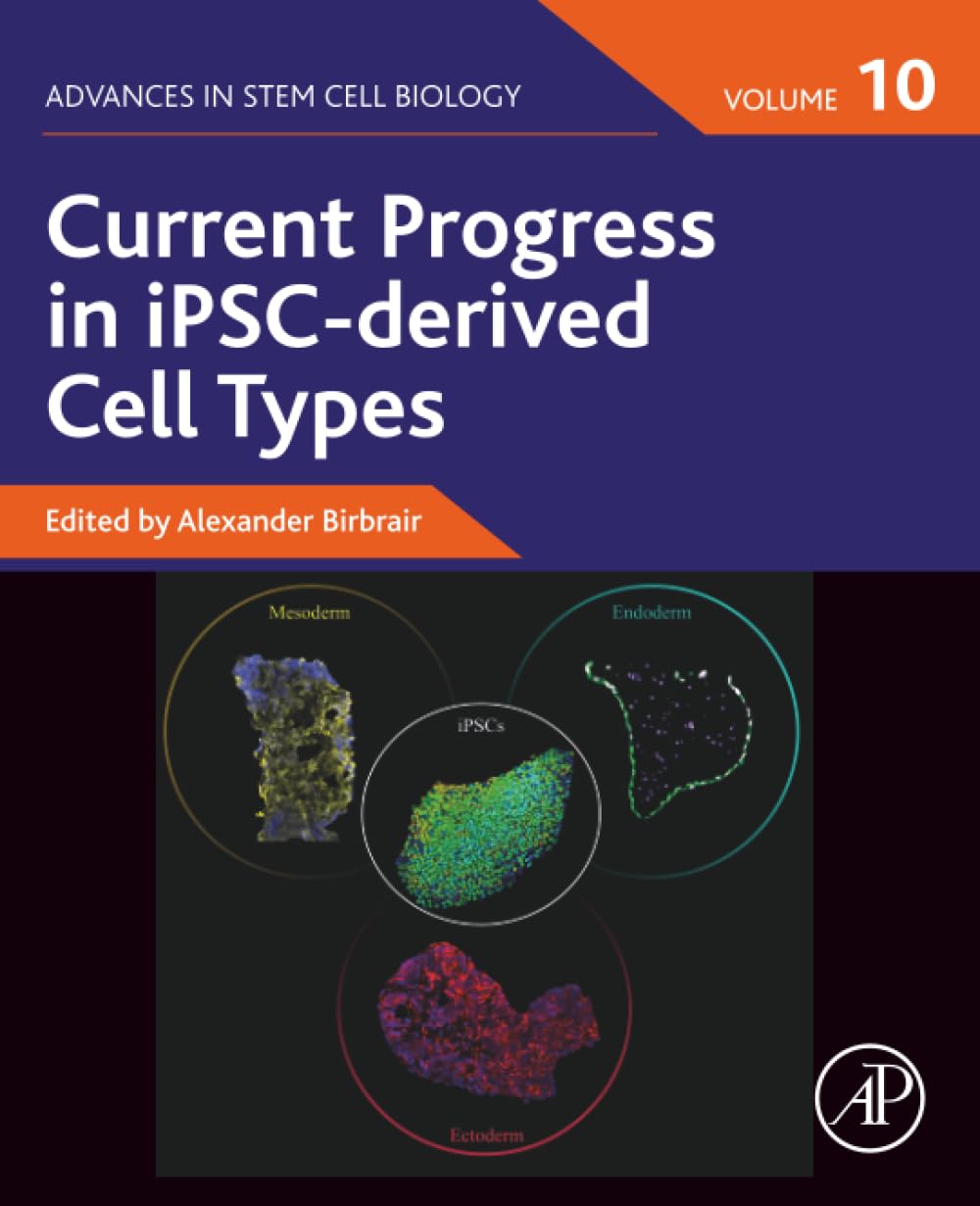 Current Progress in iPSC-derived Cell Types (Volume 10) (Advances in Stem Cell Biology